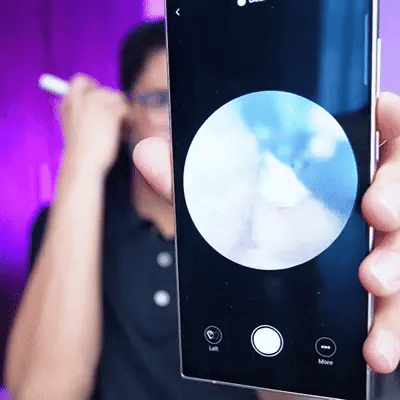 Limpiador de Oído con Cámara HD